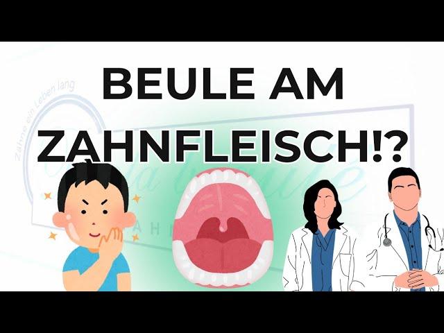 Beule am Zahnfleisch?!