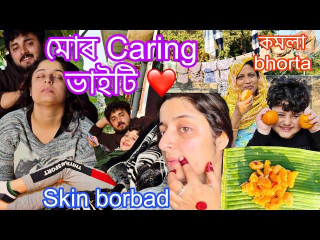 ভাইটি’e মোৰ enekua care kore  || Makeup Kori Kori skin borbad  || মজা kori কমলা Bhorta khalu ||