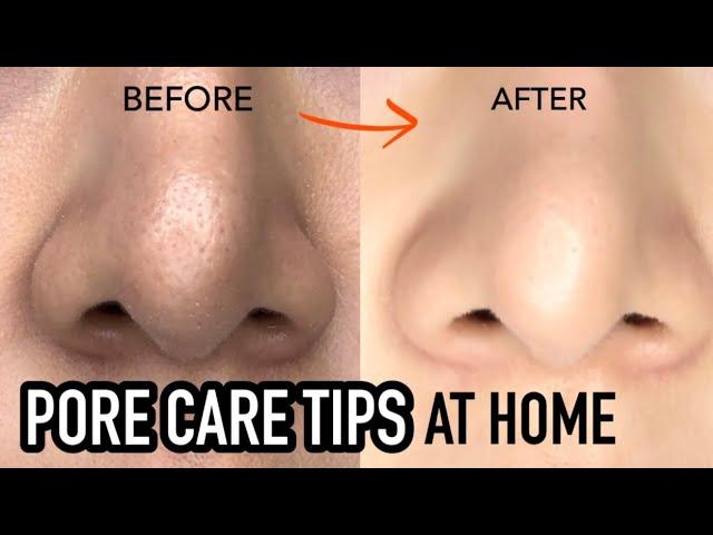 How to treat Large PORES at home | Pore Care Routine and Tips