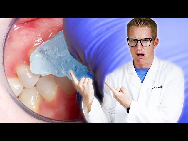  Dentist Explains TOOTH SENSITIVITY to COLD & Remedies! Why Front Teeth Hurt & Molar Toothache Pain