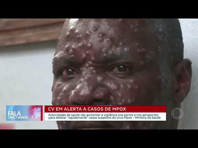 Cabo Verde em alerta a caso do vírus Mpox | Fala Cabo Verde