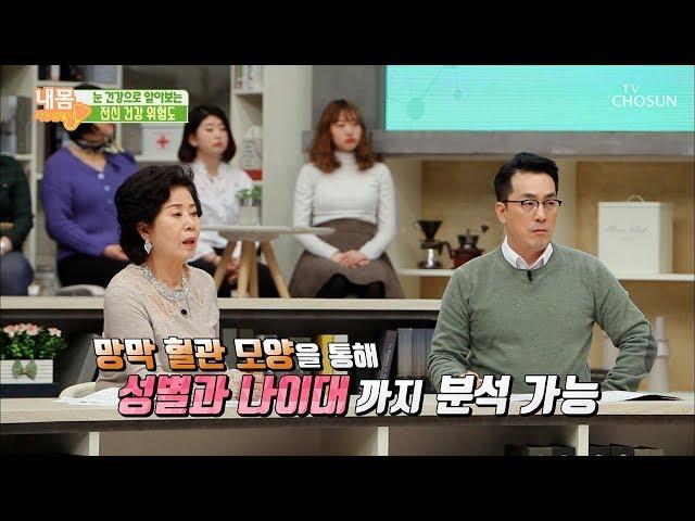 40대 이상이라면 꼭 ‘안저검사’를 받아라?! [내 몸 사용설명서] 243회 20 190314