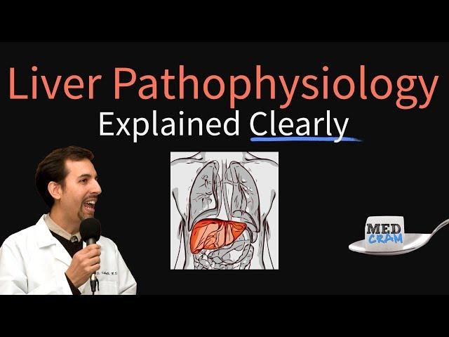 Liver Explained Clearly - Pathophysiology, LFTs, Hepatic Diseases