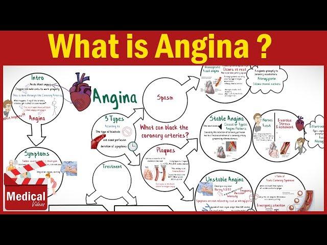 Pharmacology - What is Angina Pectoris ? Types of Angina, Symptoms, Causes &Treatment FROM A TO Z