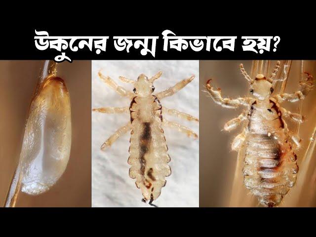 উকুনের জীবনচক্র এবং মাথায় এরা কিভাবে আসে | Lice lifecycle in detail | Funny facts #viral