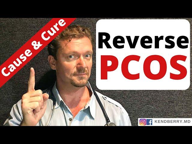 PCOS (What Causes PCOS) How to Reverse PCOS