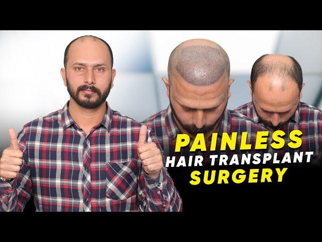 Hair Transplant in Ambala | Best Results & Cost of Hair Transplant in Ambala