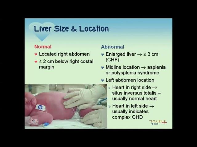 STABLE Cardiac Part I