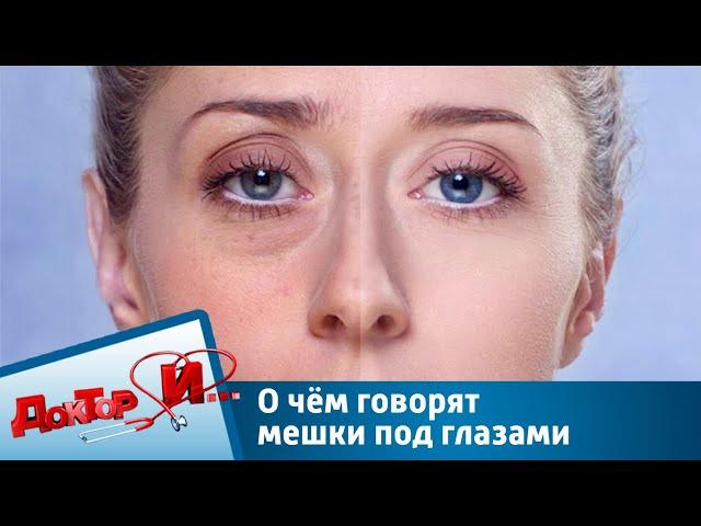 О чём говорят мешки под глазами | Доктор И