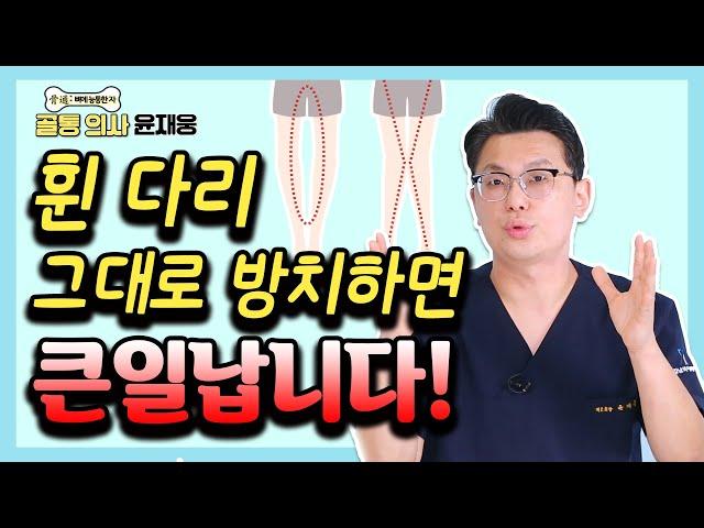 무릎 관절염 유발하는 휜 다리, 이렇게 교정하라! - 골통 의사 윤재웅 #08 휜다리 수술