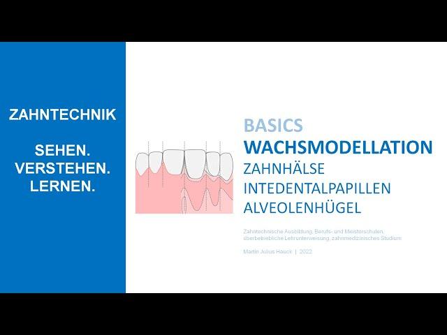 Zahnhals - Interdentalpapille - Alevolenhügel | Wachsmodellation herausnehmbare Prothetik