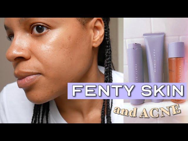 Using Fenty Skin on my ACNE PRONE and TEXTURED SKIN // FULL REVIEW #fentyskin