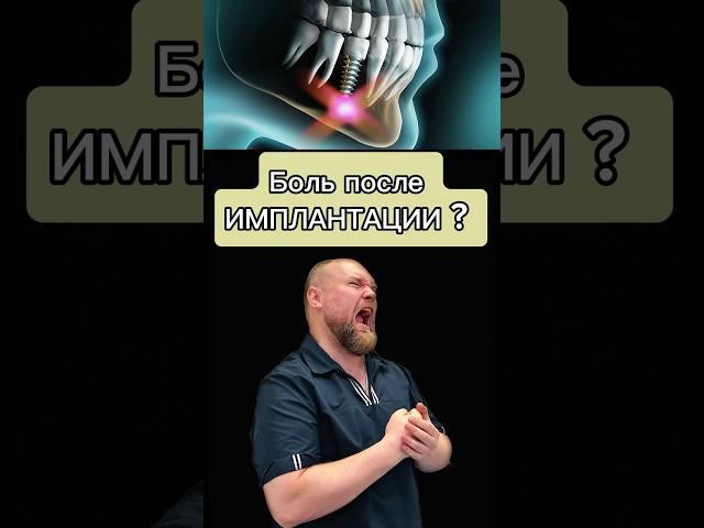 Боль после имплантации - норма или нет ? #лечениезубовмосква #имплантациязубов