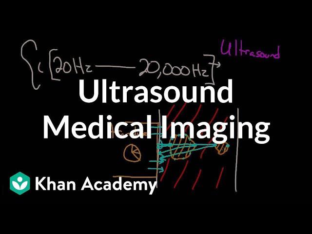 Ultrasound medical imaging | Mechanical waves and sound | Physics | Khan Academy