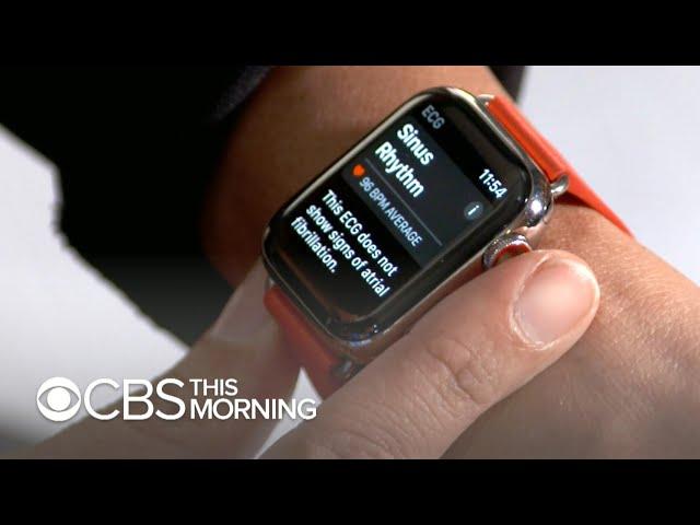 Apple Watch rolling out electrocardiograms for heart health