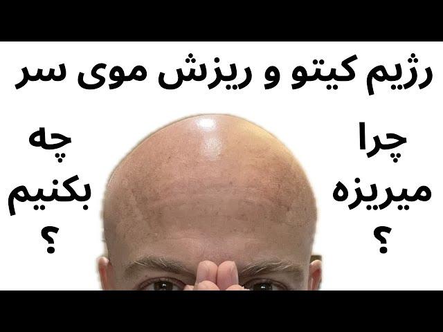 چرا بعضی ها موهاشون با رژیم کیتو میریزه؟ چاره چیه؟