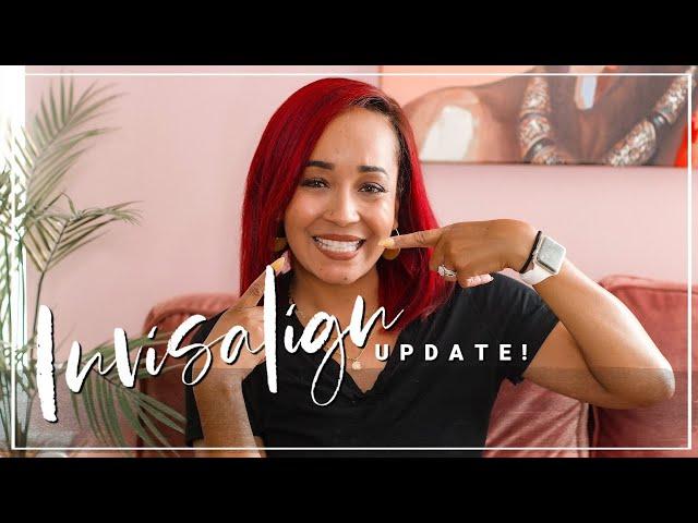 My Invisalign Journey Update - Week 20!  | Kym Yvonne