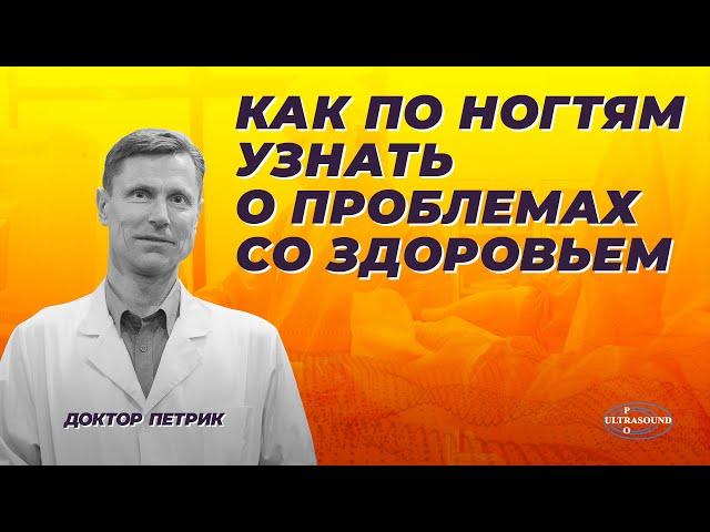 Как по ногтям узнать о проблемах со здоровьем.