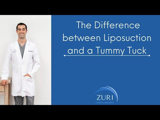 The Difference between Liposuction and a Tummy Tuck