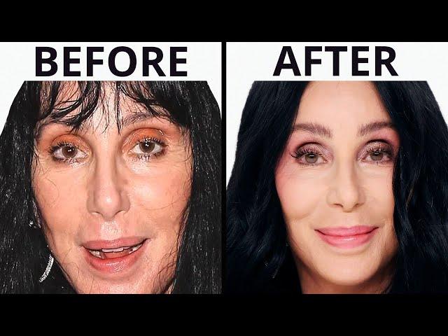 Cher's NEW FACE | Plastic Surgery Analysis