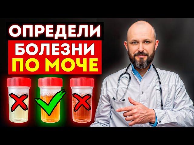 Ваши почки – НЕ В ПОРЯДКЕ! / О чем говорит ЦВЕТ МОЧИ?