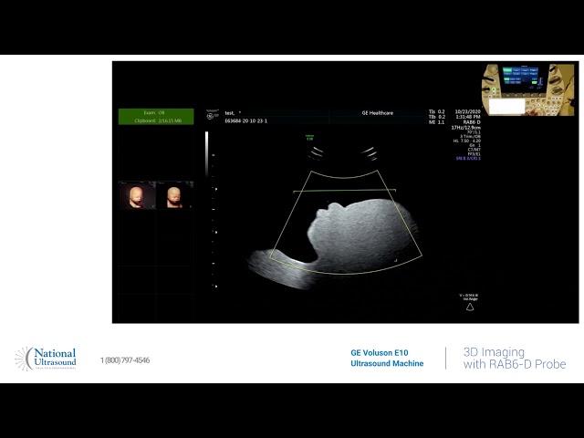 GE Voluson E10 3D Imaging Training Video Demonstration