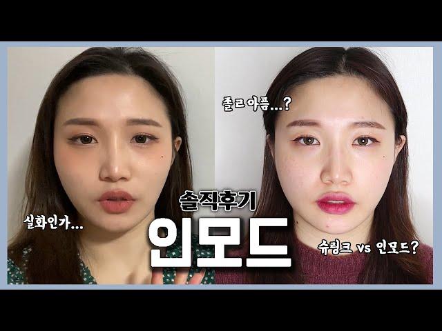 얼굴작아지는 "인모드" 레이저 | 슈링크 vs 인모드?! | 아픈만큼 효과있다..?