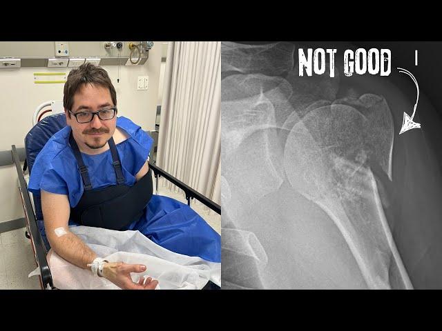 I Shattered My Shoulder... Now What?