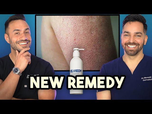 Keratosis Pilaris? Crepey Skin? New Product Alert from Remedy Science 