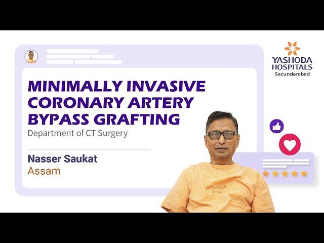 Minimally Invasive Coronary Artery Bypass Grafting | Yashoda Hospitals Hyderabad