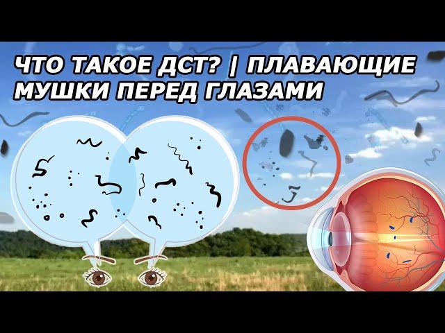 Что Такое ДСТ? / Плавающие Мушки Перед Глазами