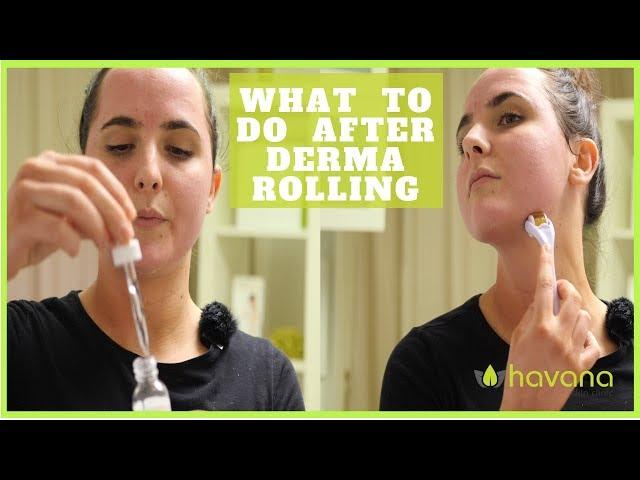 Dermarolling Aftercare - How To Properly Treat Your Skin Post Treatment