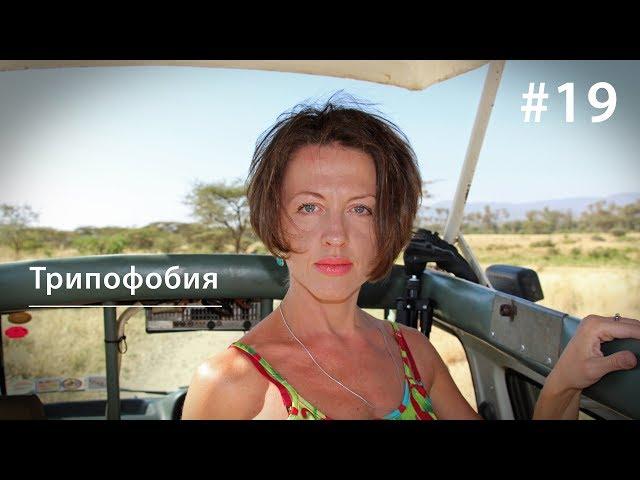 Trypophobia: Why Are We Afraid Of Holes And Hypnotised By Pimples? // Just Like Other Animals 19