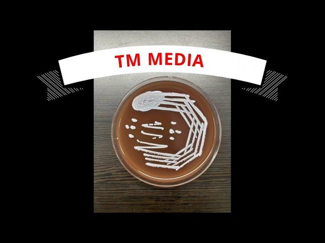 MY EXPERIENCE OF "READY TO USE MEDIA" FROM TM MEDIA