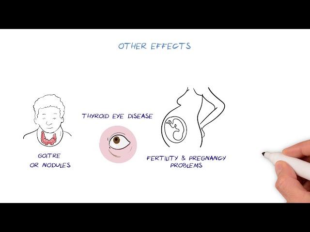 Thyroid Disease HealthSketch