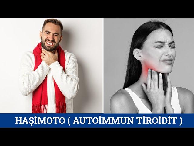 Haşimoto Xəstəliyi - Autoimmun Tiroidit - Zob Xəstəliyi - Ramin Məmmədzadə ( Endokrinoloq-Dietoloq )