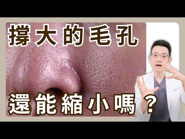 毛孔粗大會讓皮膚老化？毛孔粗大的四個原因！改善方式告訴你！