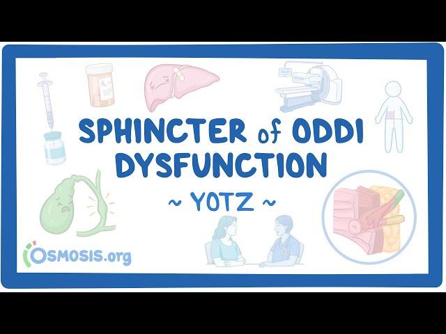 Sphincter of Oddi dysfunction (Year of the Zebra 2024)