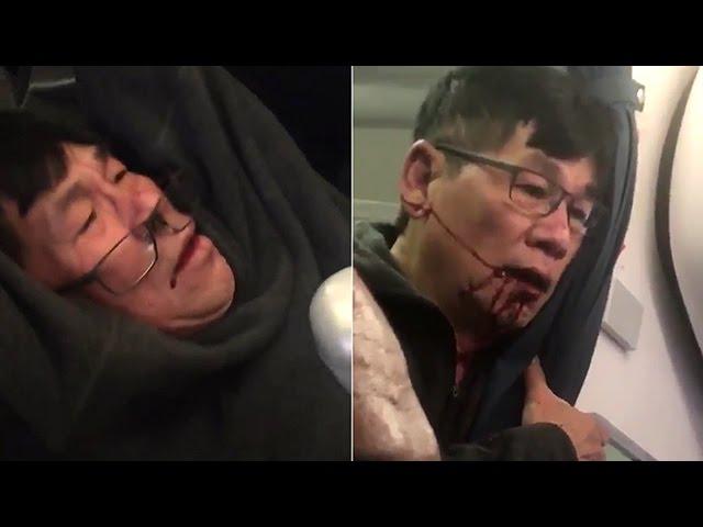 United Airlines drag man off overbooked flight