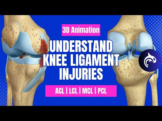 Understand Knee Ligament Injuries (ACL, PCL, MCL, LCL) - 3D animation