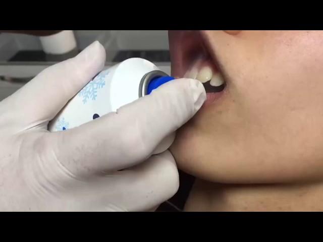 Smile Piercing (Manisa Piercing)