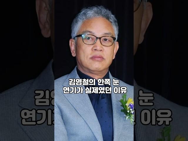 김영철의 한쪽 눈 연기가 실제였던 이유