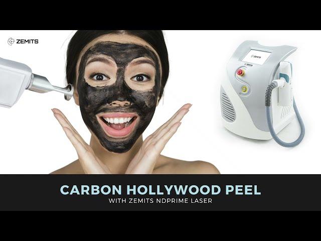 Hollywood Carbon Peel Facial Tutorial. How the Laser Carbon Peel Works.