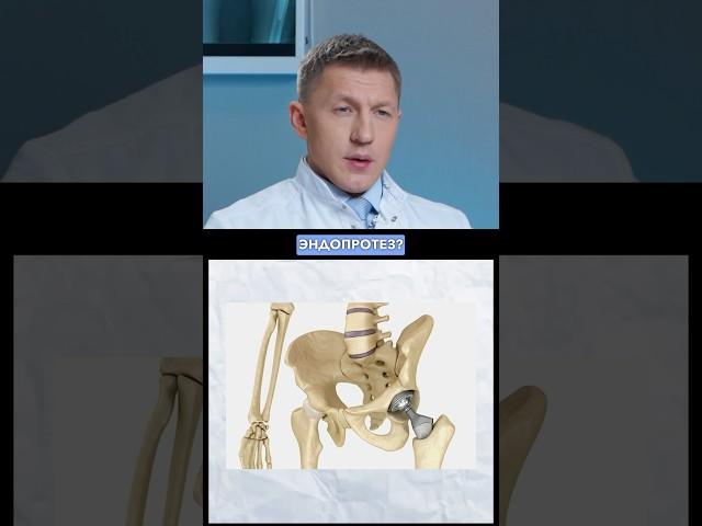 Вам нельзя ставить эндопротез тазобедренного сустава если у вас