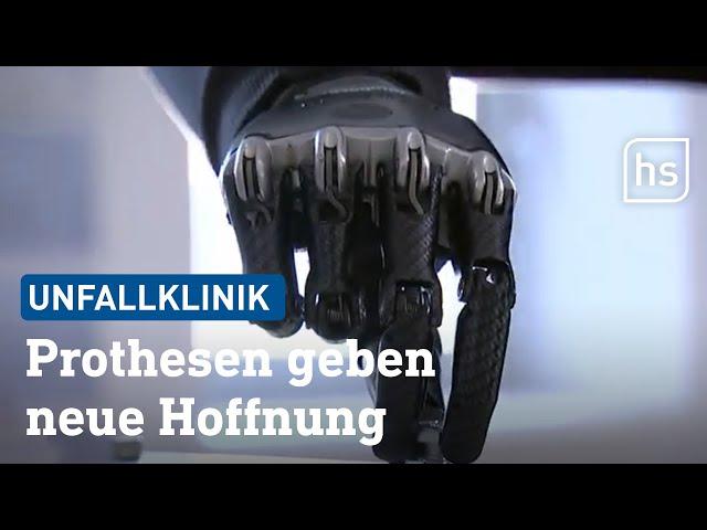 Hightech-Prothesen aus Frankfurt | hessenschau