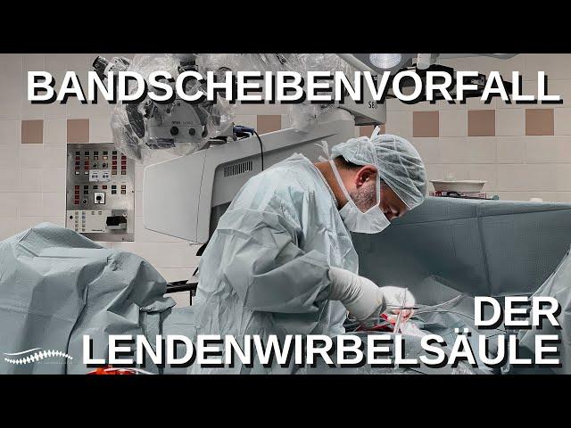 Bandscheibenvorfall der Lendenwirbelsäule#rückenschmerz#wirbelsäule#bandscheibenvorfall#operation