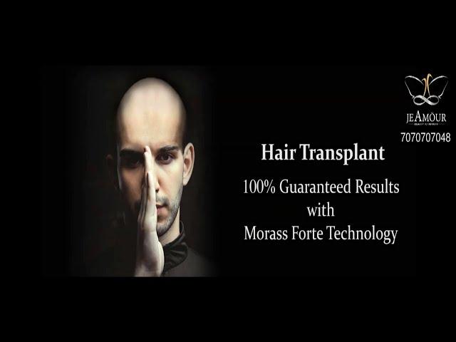 Best Hair Transplant Technology in India | Je Amöur