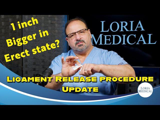 Ligament Release procedure Update. #2024