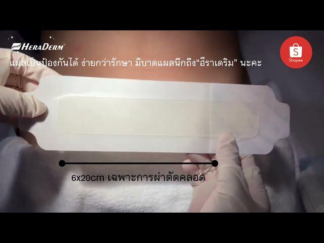 HeraDerm Thailand | การดูแลบาดแผล | วิธีใช้การแต่งเติมไฮโดรเจล