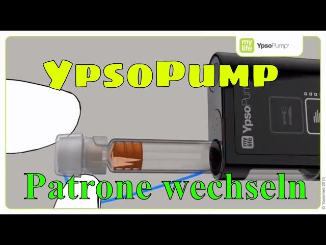 YpsoPump Patrone wechseln Insulinpumpe mylife Diabetescare 08